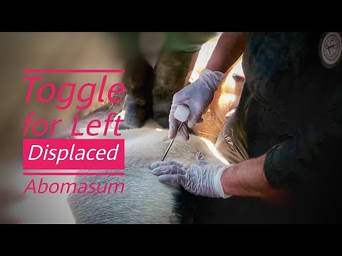 Abomasum Displacement | Roll and Toggle