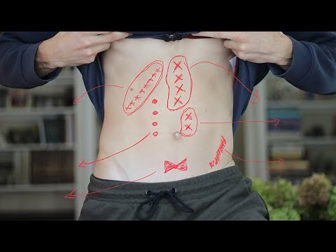 Two Signs of Liver & Gallbladder Problems According to Traditional Chinese Medicine