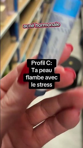 Acné hormonale chez la femme : 3 profils selon tes boutons