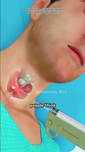 How Thyroid Biopsy Procedure Is Performed? (3D Animation)