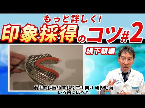 もっと詳しく！印象採得のコツ＃２（下顎の入れ歯などの印象の際、欠損部を綺麗に採る為のアイテムやコツの伝授）