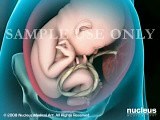 Breech Birth Position  • Video • MEDtube.net