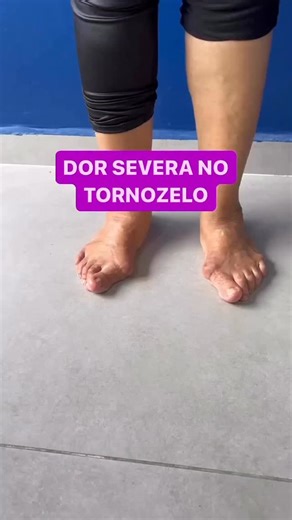 15K views · 235 reactions | Paciente há semanas com dor severa no...