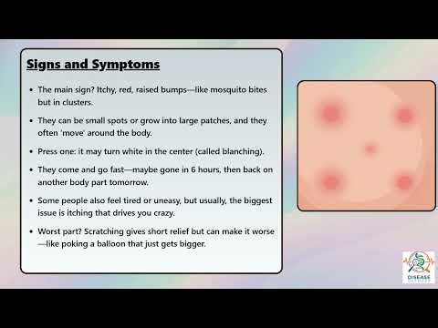 Urticaria (Hives) (Type I) Explained Causes, Symptoms and Treatment, All Insights