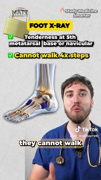 Ottawa Ankle Rules for Medical Exams Explained