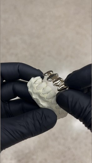 Permanent retainers? No problem 😎👍 #grillz | Custom Gold Grillz