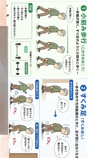 パーキンソン病「四大症状編」