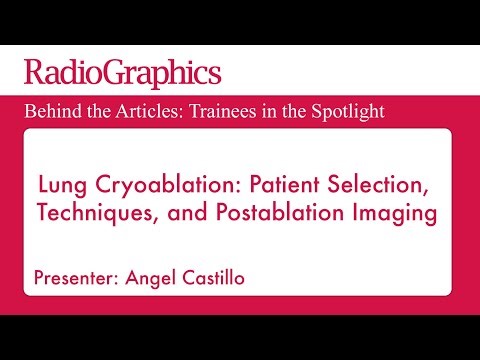 Lung Cryoablation: Patient Selection,Techniques, and Postablation Imaging