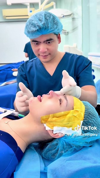 #drlee #rhinoplasty #chinlift #tiktokviral #videoviral