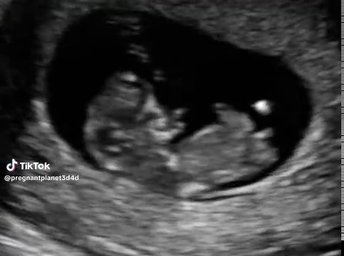Pregnancy is a true miracle—a new life growing inside you, guided by love and instinct. The first ultrasound is unforgettable: seeing your baby’s tiny form and hearing their heartbeat brings a wave of emotion—joy, awe, love, and wonder. It’s the moment you realize you’re never alone again. That flicker on the screen is your whole world beginning, and from that point on, everything changes. Pregnancy and ultrasounds remind us just how extraordinary and beautiful life is. They’re a testament to ho