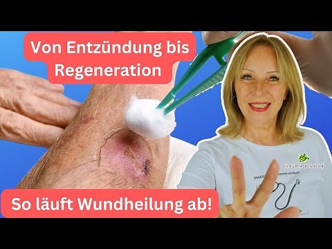 The 3 phases of wound healing explained – medicine in brief! | Dr. Claudia Bignion