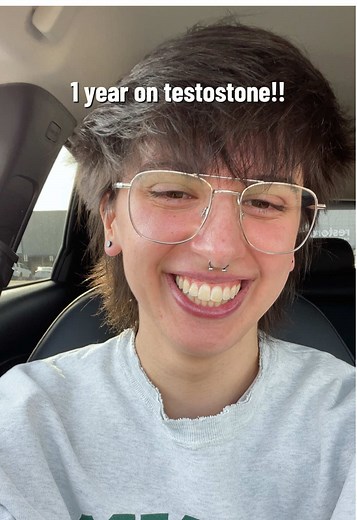 1 Year on Testosterone: Transition Update for Transmasc