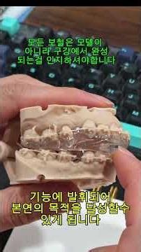하 편. 이갈이장치와 안정화splint의 한끗차이는 작업자의 마인드에서 비롯됩니다.#exocad #3dprint #3shape #graphy #투명교정