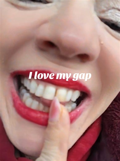 yes I one tooth is have a fake tooth. I chipped it when I was young##genx #mylife #greatful