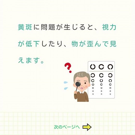眼科の病気と症状①加齢黄斑変性