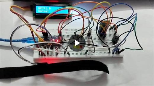 #biomedicalengineering #miniproject #sensorfusion #embeddedsystems #arduino #realtimemonitoring #healthcareinnovation #bioelectronics #technicalskills | Lisha S