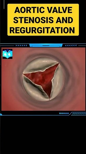 Aortic value stenosis and regurgitation. #studyanimated #biology #animation #science