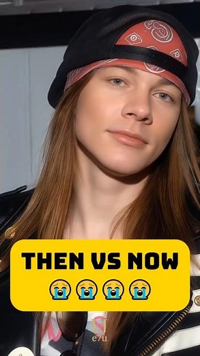 Guns N’ Roses Then vs Now | Axl Rose & Slash Evolution #gnr #rocklegends