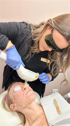 JoAnna Weber, FNP-C Med Spa Denver & Lake Norman on Instagram: "✨ IPL: Intense Pulse Light ✨ Say goodbye👋 to uneven skin tone and hello to radiant, clear skin! IPL treatments target brown spots, age spots, sun damage, and redness — including concerns caused by rosacea, visible blood vessels, or diffuse redness. 📅 Book your session today at skinsationalaesthetics.org and reveal your most confident complexion!"