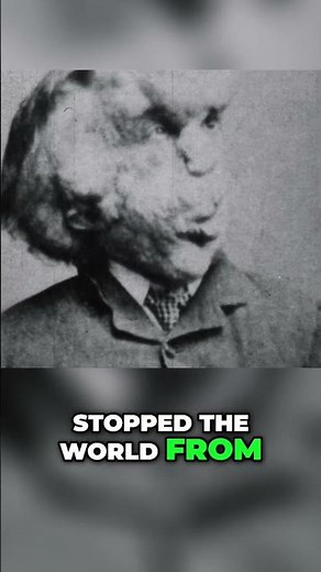The ELEPHANT MAN!! #history #short
