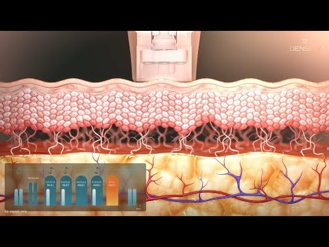 DENSITY RF | Dual-Mode Radiofrequency Technology Explained | Jeisys Medical