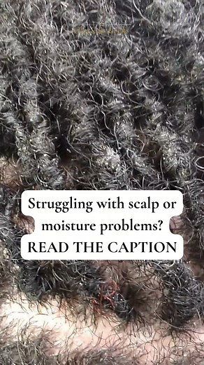 Struggling with scalp or moisture problems? You’re not alone! 🙋🏽‍♀️ Dry flakes… itchiness… tight scalp… dull-looking locks… Most times, it’s simply your scalp asking for more consistent care & moisture Here’s your reminder: Your locks can ONLY thrive when your scalp is healthy first. Healthy roots = healthy growth If your scalp has been: • Itchy or irritated • Flaky or tight • Lacking moisture • More breakage than usual It’s time to show it some love! 💛 🛍️ Early Black Friday Deals are HERE! 