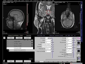 HOW TO DO MRI TM JOINT