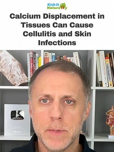 Calcium Displacement in Tissues Can Cause Cellulitis and Skin Infections To see the full video on 3 Ways to Stop Recurring Cellulitis and Skin Infections Naturally, go to https://www.youtube.com/watch?v=L3jipCtxiJY Subscribe to our main Kick It Naturally Channel here httpswww.youtube.comchannelUCEN08D5qYz8EHvwixHckYbgsub_confirmation=1 ➤ Register for our TOTALLY FREE 4-Week Online Digestion Course to better understand your unique body chemistry and which aspects of digestion may need a little bo