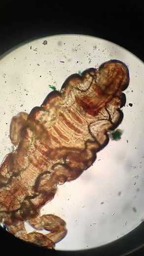 human head lice (under microscope)