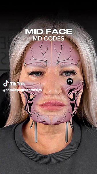 Advanced Facial Contouring Techniques with MD Codes