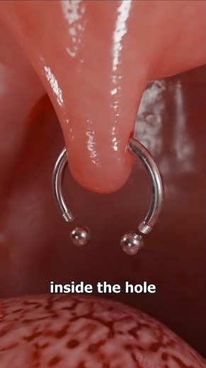 "Uvula Infection: Causes, Symptoms, and Quick Relief Tips!"#ytshorts #youtubeshorts #facts #viral