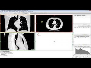 Mimics Innovation Suite Introduction - Dicom Image Import and Interface Layout