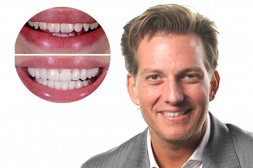 ‘RHOBH’ Recap: Dorit Kemsley details coparenting drama with PK — and Kyle Richards opens up to about past relationship