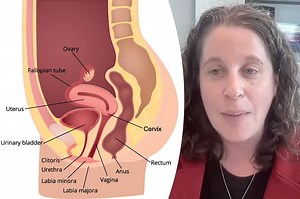 Women are just finding out they lose part of their vaginas during menopause