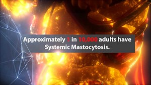 6.4K views · 64 reactions | Systemic mastocytosis (SM) is characterized by the overactivity and build-up of mast cells throughout the body. Oncologist Dr. Prithviraj Bose shares how symptoms of SM not only vary, but range across multiple organs making it difficult to diagnose. #BehindtheMystery | The Balancing Act | Facebook
