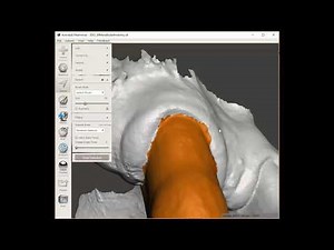 Comment segmenter une dent avec MeshMixer