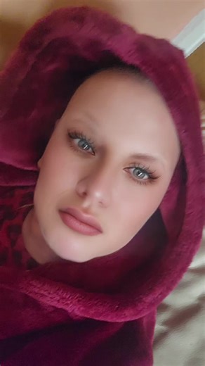 #Functional Neurological Disorder#temporal arteritis,Warrior💪❤️