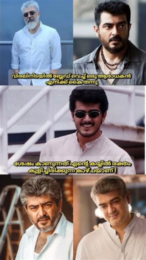 💔തലയെ പോലെ ആരുണ്ട്💔#shorts iral #fyp#trending