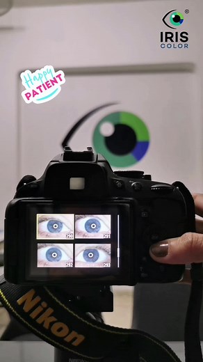 Iris Color Laser on TikTok