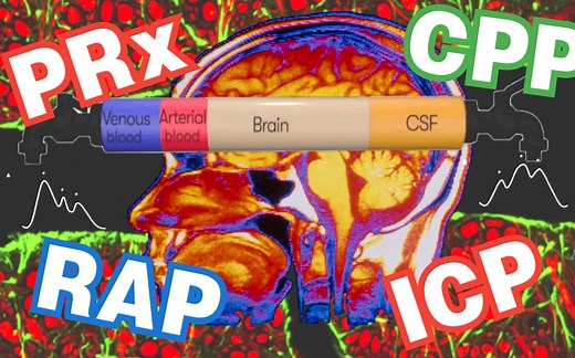 颅内压监测---神的领域也有压力