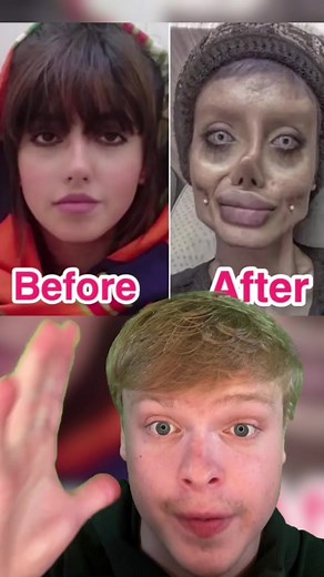 Plastic surgery that went WAY too far 🤯 #facts #plasticsurgery #transformation