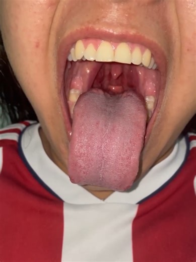 The Fascinating World of Long Tongues