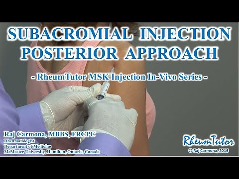 SUBACROMIAL INJECTION POSTERIOR APPROACH - In-Vivo Series