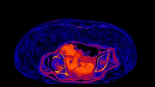 2,000-Year Mystery: What Happened to the Fetus Inside the Pregnant Mummy?