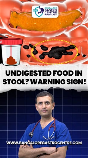 Why Is Food Not Digesting Properly? Undigested Food in Stool Explained