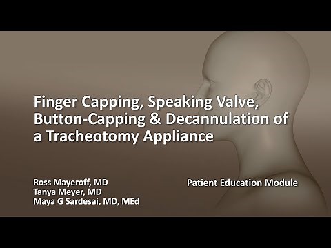 Finger Capping, Speaking Valve, Button-Capping & Decannulation of a Tracheotomy Appliance