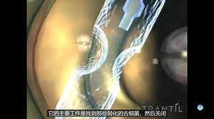 便秘胀气？阿特兰蒂（atrantil）原理