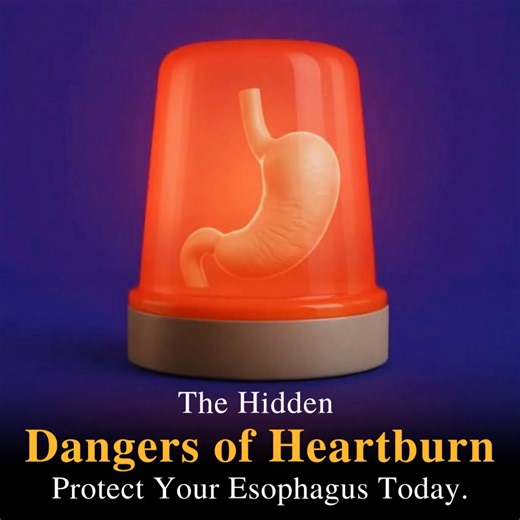 That ‘acid attack’ at 2 AM might be the hidden threat. My GI warned me: if I ignore this, it could turn into something serious. Last week, my GI doctor gave me some news that shook me to the core. After my endoscopy, he told me something terrifying: “If you leave this untreated, it could eventually lead to Barrett's esophagus." Hearing those words made my anxiety skyrocket. My GI is compassionate, but all he offered were more omeprazole. He simply said, “Keep taking your medication and avoid spi