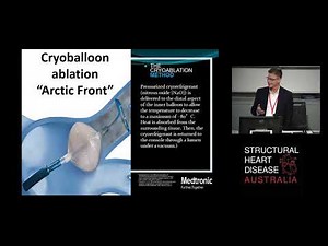 Atrial Fibrillation Ablation: Radiofrequency vs Cryoballoon - Dr David Whalley