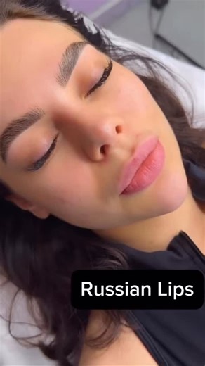 COSMETOLOGY • FULL FACE • RUSSIAN LIPS • BOTOX on Instagram: "Russian Lips — Luxury. Elegance. Perfection. 💋✨ Soft, lifted, perfectly shaped lips with a refined, high-end finish. No exaggeration — just silky, feminine, luxury lips that elevate your whole face ✨ 📍 Los Angeles 📲 DM to book #RussianLips #LuxuryAesthetics #LipFillerLA #ElegantBeauty #LatinaBeauty #LAmedspa #HighEndAesthetics"